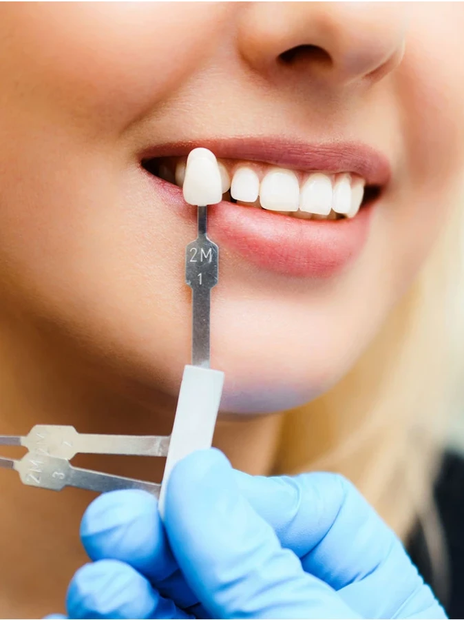 реставрация зубов