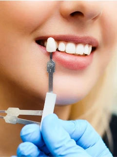 реставрация зубов