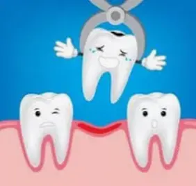 Безболезненное простое удаление зуба профессиональным стоматологом-хирургом.