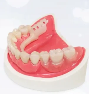 Несъемное протезирование: Восстановление зуба ацеталовой коронкой