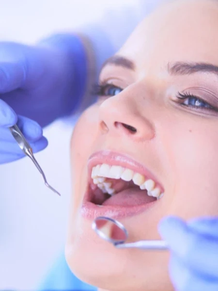 Фото для Лечение кариеса у взрослых