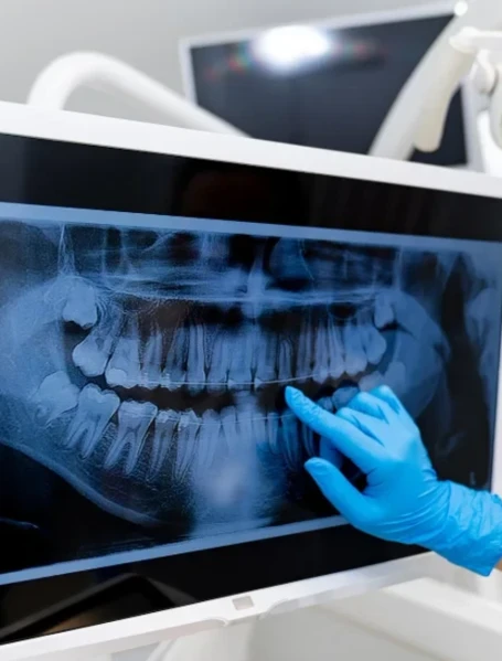 Фото для Телерентгенограмма (ТРГ) в боковой проекции