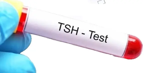 Исследование уровня тиреотропного гормона (ТТГ) плазмы крови ИФА методом