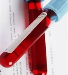 Исследование уровня дегидроэпиандростерона сульфата (ДГЭА -с ) в крови ИФА методом